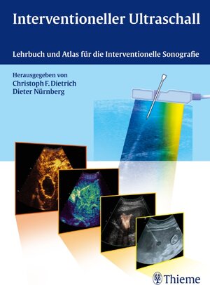 Buchcover Interventioneller Ultraschall  | EAN 9783131311313 | ISBN 3-13-131131-2 | ISBN 978-3-13-131131-3