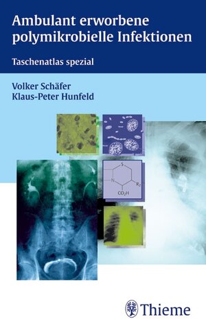 Buchcover Ambulant erworbene polymikrobielle Infektionen | Klaus-Peter Hunfeld | EAN 9783131328618 | ISBN 3-13-132861-4 | ISBN 978-3-13-132861-8
