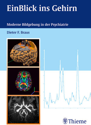 EinBlick ins Gehirn: Moderne Bildgebung in der Psychiatrie