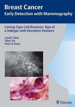 Buchcover Casting-Type Calcifications: Sign of a Subtype with Deceptive Features | Laszlo Tabar | EAN 9783131353917 | ISBN 3-13-135391-0 | ISBN 978-3-13-135391-7