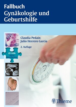 Buchcover Fallbuch Gynäkologie und Geburtshilfe  | EAN 9783131363725 | ISBN 3-13-136372-X | ISBN 978-3-13-136372-5