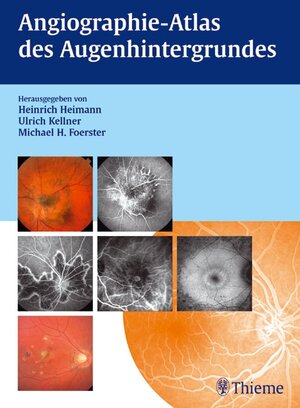 Angiographie- Atlas des Augenhintergrundes