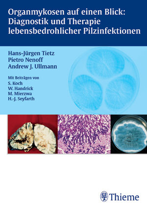 Organmykosen auf einen Blick: Diagnostik und Therapie lebensbedrohlicher Pilzinfektionen. Diagnostik und Therapie lebensbedrohlicher Pilzinfektionen
