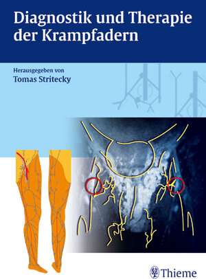 Diagnostik und Therapie der Krampfadern. Mit CD-ROM