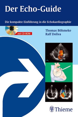 Der Echo-Guide. Mit CD-ROM: Die kompakte Einführung in die Echokardiographie