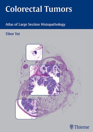 Buchcover Colorectal Tumors | Tibor Tot | EAN 9783131405913 | ISBN 3-13-140591-0 | ISBN 978-3-13-140591-3