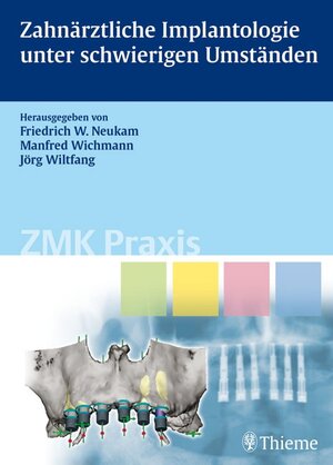 Buchcover Zahnärztliche Implantologie unter schwierigen Umständen  | EAN 9783131418210 | ISBN 3-13-141821-4 | ISBN 978-3-13-141821-0