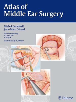 Buchcover Atlas of Middle Ear Surgery | Michel Gersdorff | EAN 9783131450418 | ISBN 3-13-145041-X | ISBN 978-3-13-145041-8