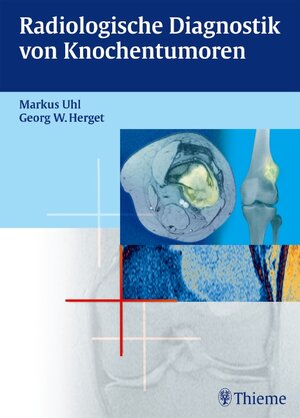 Buchcover Radiologische Diagnostik von Knochentumoren | Georg W. Herget | EAN 9783131456618 | ISBN 3-13-145661-2 | ISBN 978-3-13-145661-8