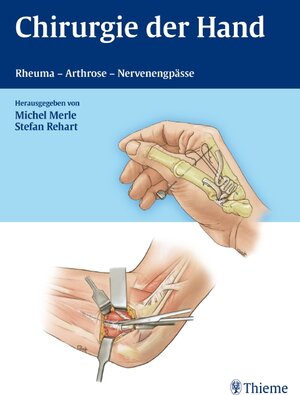 Buchcover Chirurgie der Hand | Michel Merle | EAN 9783131481511 | ISBN 3-13-148151-X | ISBN 978-3-13-148151-1