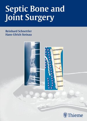 Buchcover Septic Bone and Joint Surgery | Reinhard Schnettler | EAN 9783131490315 | ISBN 3-13-149031-4 | ISBN 978-3-13-149031-5