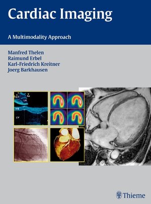 Buchcover Cardiac Imaging  | EAN 9783131493316 | ISBN 3-13-149331-3 | ISBN 978-3-13-149331-6