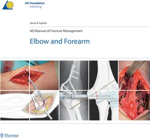 Buchcover AO Manual of Fracture Management - Elbow and Forearm | Jesse Jupiter | EAN 9783131494610 | ISBN 3-13-149461-1 | ISBN 978-3-13-149461-0