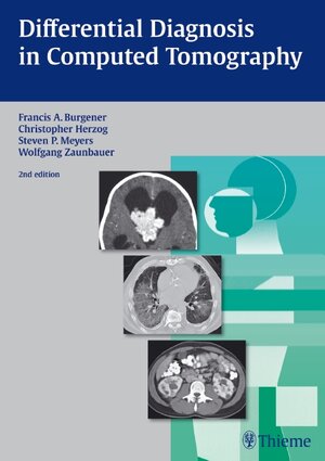 Buchcover Differential Diagnosis in Computed Tomography | Francis A. Burgener | EAN 9783131502827 | ISBN 3-13-150282-7 | ISBN 978-3-13-150282-7