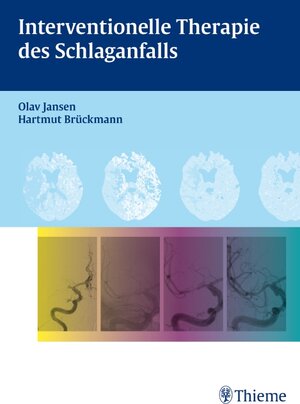 Buchcover Interventionelle Therapie des Schlaganfalls  | EAN 9783131535115 | ISBN 3-13-153511-3 | ISBN 978-3-13-153511-5