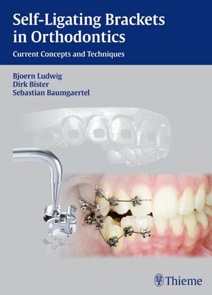 Buchcover Self-ligating Brackets in Orthodontics | Björn Ludwig | EAN 9783131547019 | ISBN 3-13-154701-4 | ISBN 978-3-13-154701-9