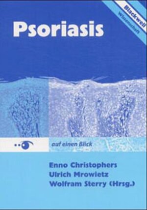 Buchcover Psoriasis auf einen Blick 3894125470  | EAN 9783131554024 | ISBN 3-13-155402-9 | ISBN 978-3-13-155402-4