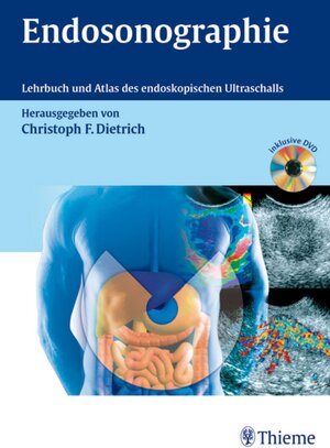 Buchcover Endosonographie | Christoph Frank Dietrich | EAN 9783131555311 | ISBN 3-13-155531-9 | ISBN 978-3-13-155531-1