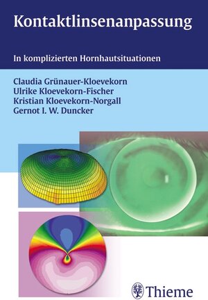 Buchcover Kontaktlinsenanpassung | Claudia Grünauer-Kloevekorn | EAN 9783131561411 | ISBN 3-13-156141-6 | ISBN 978-3-13-156141-1