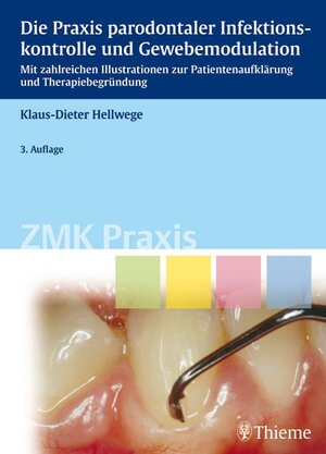 Buchcover Die Praxis parodontaler Infektionskontrolle und Gewebemodulation | Klaus-Dieter Hellwege | EAN 9783131563439 | ISBN 3-13-156343-5 | ISBN 978-3-13-156343-9