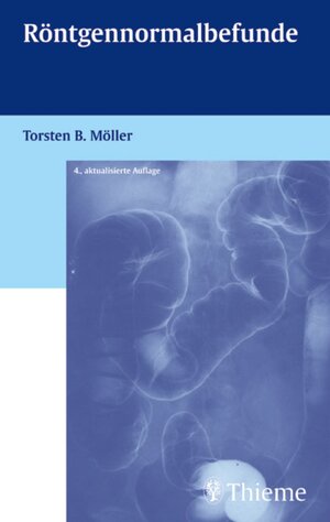Buchcover Röntgennormalbefunde | Torsten Bert Möller | EAN 9783131600943 | ISBN 3-13-160094-2 | ISBN 978-3-13-160094-3