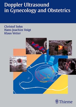 Buchcover Doppler Ultrasound in Gynecology and Obstetrics | Christof Sohn | EAN 9783131607713 | ISBN 3-13-160771-8 | ISBN 978-3-13-160771-3