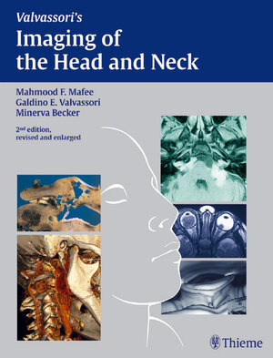 Buchcover Imaging of the Head and Neck | Mahmood F. Mafee | EAN 9783131634825 | ISBN 3-13-163482-0 | ISBN 978-3-13-163482-5