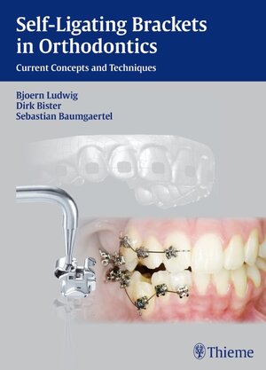 Buchcover Self-Ligating Brackets in Orthodontics | Björn Ludwig | EAN 9783131645012 | ISBN 3-13-164501-6 | ISBN 978-3-13-164501-2