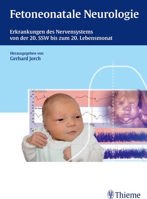 Buchcover Fetoneonatale Neurologie  | EAN 9783131653215 | ISBN 3-13-165321-3 | ISBN 978-3-13-165321-5