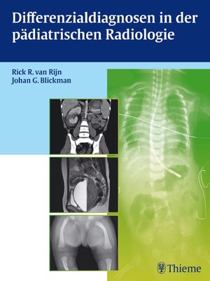 Buchcover Differenzialdiagnosen in der pädiatrischen Radiologie  | EAN 9783131695710 | ISBN 3-13-169571-4 | ISBN 978-3-13-169571-0