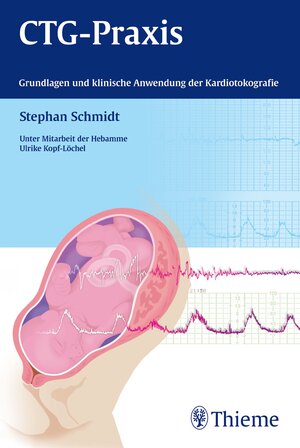 Buchcover CTG-Praxis | Stephan Schmidt | EAN 9783131699718 | ISBN 3-13-169971-X | ISBN 978-3-13-169971-8
