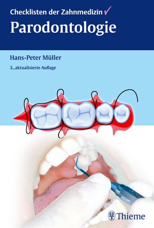 Buchcover Checklisten der Zahnmedizin Parodontologie | Hans-Peter Müller | EAN 9783131699930 | ISBN 3-13-169993-0 | ISBN 978-3-13-169993-0