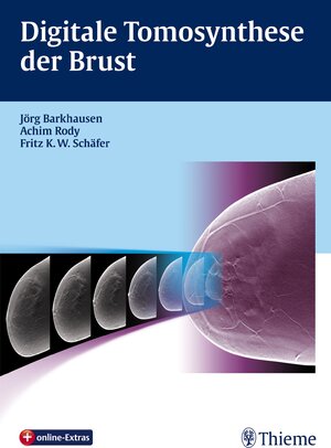 Buchcover Digitale Tomosynthese der Brust  | EAN 9783131708915 | ISBN 3-13-170891-3 | ISBN 978-3-13-170891-5