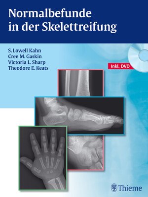 Buchcover Normalbefunde in der Skelettreifung | S. Lowell Kahn | EAN 9783131723413 | ISBN 3-13-172341-6 | ISBN 978-3-13-172341-3