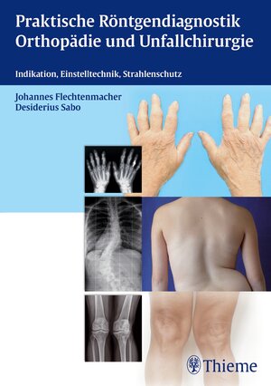 Buchcover Praktische Röntgendiagnostik Orthopädie und Unfallchirurgie  | EAN 9783131731616 | ISBN 3-13-173161-3 | ISBN 978-3-13-173161-6