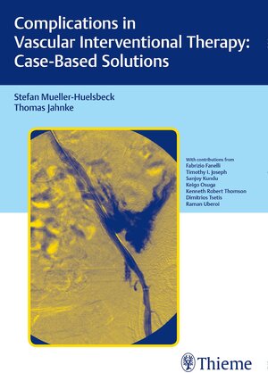 Buchcover Complications in Vascular Interventional Therapy: Case-Based Solutions | Stefan Müller-Hülsbeck | EAN 9783131758316 | ISBN 3-13-175831-7 | ISBN 978-3-13-175831-6