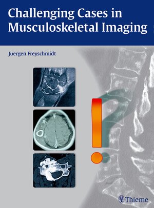 Buchcover Challenging Cases in Musculoskeletal Imaging | Jürgen Freyschmidt | EAN 9783131764010 | ISBN 3-13-176401-5 | ISBN 978-3-13-176401-0