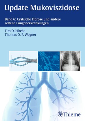 Buchcover Update Mukoviszidose, Band 6 | EAN 9783131769817 | ISBN 3-13-176981-5 | ISBN 978-3-13-176981-7