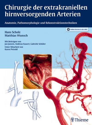 Buchcover Chirurgie der extrakraniellen hirnversorgenden Arterien | Hans Scholz | EAN 9783131772817 | ISBN 3-13-177281-6 | ISBN 978-3-13-177281-7