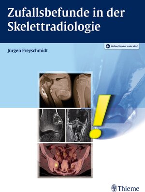 Buchcover Zufallsbefunde in der Skelettradiologie | Jürgen Freyschmidt | EAN 9783131982216 | ISBN 3-13-198221-7 | ISBN 978-3-13-198221-6