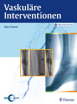 Buchcover Vaskuläre Interventionen  | EAN 9783132006515 | ISBN 3-13-200651-3 | ISBN 978-3-13-200651-5