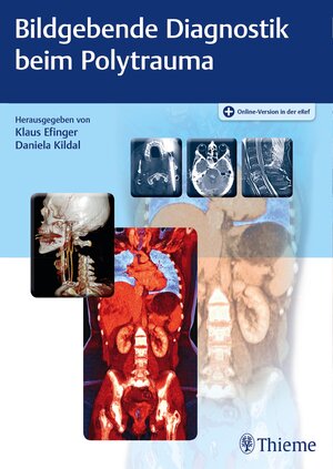 Buchcover Bildgebende Diagnostik beim Polytrauma  | EAN 9783132007819 | ISBN 3-13-200781-1 | ISBN 978-3-13-200781-9