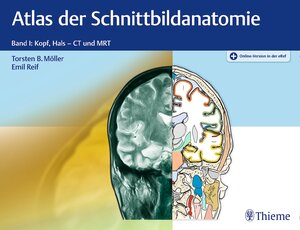 Buchcover Atlas der Schnittbildanatomie | Torsten Bert Möller | EAN 9783132032217 | ISBN 3-13-203221-2 | ISBN 978-3-13-203221-7
