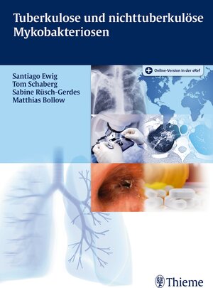 Buchcover Tuberkulose und nicht tuberkulöse Mykobakteriosen | Santiago Ewig | EAN 9783132046016 | ISBN 3-13-204601-9 | ISBN 978-3-13-204601-6