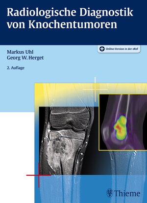 Buchcover Radiologische Diagnostik von Knochentumoren  | EAN 9783132052123 | ISBN 3-13-205212-4 | ISBN 978-3-13-205212-3