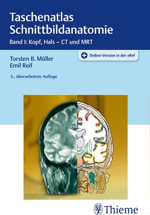 Buchcover Taschenatlas Schnittbildanatomie | Torsten Bert Möller | EAN 9783132403161 | ISBN 3-13-240316-4 | ISBN 978-3-13-240316-1