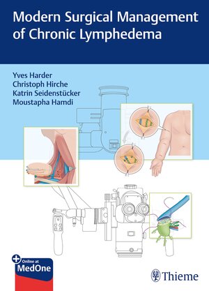 Buchcover Modern Surgical Management of Chronic Lymphedema  | EAN 9783132414372 | ISBN 3-13-241437-9 | ISBN 978-3-13-241437-2