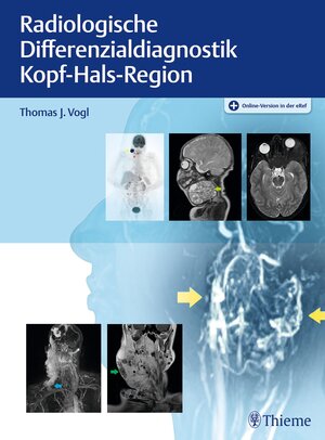 Buchcover Radiologische Differenzialdiagnostik Kopf-Hals-Region  | EAN 9783132414891 | ISBN 3-13-241489-1 | ISBN 978-3-13-241489-1