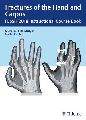 Buchcover Fractures of the Hand and Carpus  | EAN 9783132417205 | ISBN 3-13-241720-3 | ISBN 978-3-13-241720-5
