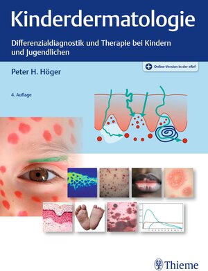Buchcover Kinderdermatologie | Peter Höger | EAN 9783132420656 | ISBN 3-13-242065-4 | ISBN 978-3-13-242065-6